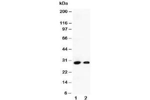 Western blot testing of Granzyme B antibody and Lane 1:  human SMMC-7721