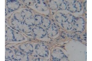 Detection of ABCA1 in Mouse Intestine Tissue using Polyclonal Antibody to ATP Binding Cassette Transporter A1 (ABCA1)