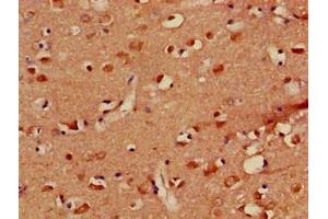 Immunohistochemistry of paraffin-embedded human brain tissue using ABIN7163717 at dilution of 1:100 (PLXND1 anticorps  (AA 1-222))