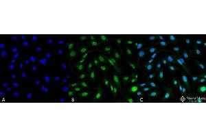 Immunocytochemistry/Immunofluorescence analysis using Mouse Anti-MDC1 Monoclonal Antibody, Clone P2B11 . (MDC1 anticorps  (N-Term) (Biotin))