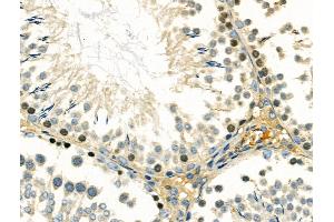 ABIN6260199 and ABIN6266752 at 1/100 staining Rat testis tissue by IHC-P.