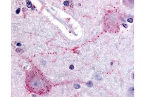 Anti-PACE4 antibody IHC of human brain, cortex.