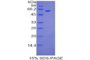 SDS-PAGE analysis of Human LRP8 Protein.