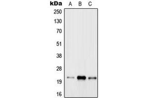Western blot analysis of RAB31 expression in MCF7 (A), Raw264. (RAB31 anticorps  (Center))