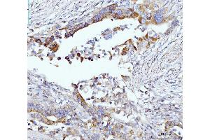 IHC analysis of Glutaminase/GLS using anti-Glutaminase/GLS antibody (ABIN7601601). (Glutaminase anticorps  (AA 396-654))