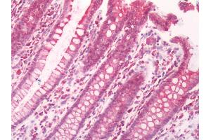 Human Colon: Formalin-Fixed, Paraffin-Embedded (FFPE)