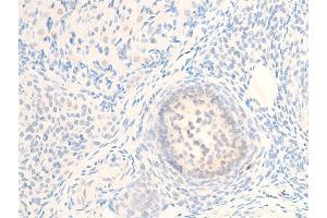 ABIN6267244 at 1/100 staining rat ovarian tissue sections by IHC-P. (MITF anticorps  (pSer73, pSer180))