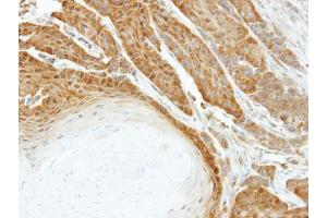 IHC-P Image Immunohistochemical analysis of paraffin-embedded SG xenograft, using HSPA6, antibody at 1:500 dilution.