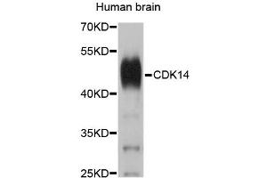 Western blot analysis of extracts of human brain, using CDK14 antibody (ABIN5995451). (CDK14 anticorps)