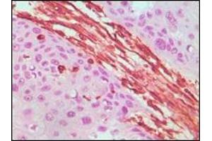 Immunohistochemistry (IHC) image for anti-Vimentin (VIM) (truncated) antibody (ABIN2464120)