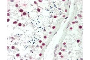 Human Testis: Formalin-Fixed, Paraffin-Embedded (FFPE) (PDS5B anticorps  (C-Term))