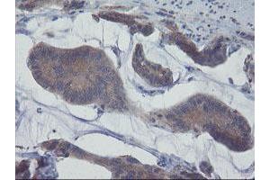 Image no. 6 for anti-Prefoldin Subunit 3 (PFDN3) antibody (ABIN1501700)