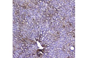 IHC analysis of COX IV using anti-COX IV antibody .