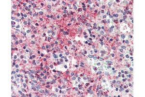 Anti-CCL5 / RANTES antibody IHC of human spleen. (CCL5 anticorps)