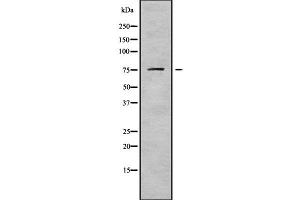 Western blot analysis of DDX18 using HuvEc whole cell lysates (DDX18 anticorps  (N-Term))