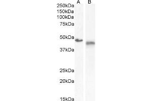 (ABIN570867) (0. (IL1R2 anticorps  (Internal Region))