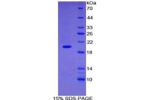 SDS-PAGE of Protein Standard from the Kit  (Highly purified E.