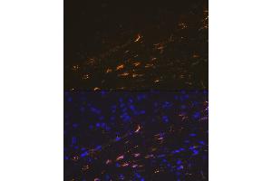 Immunofluorescence analysis of mouse brain cells using GFAP Rabbit pAb (ABIN3020750, ABIN3020751, ABIN3020752, ABIN1512943 and ABIN6213705) at dilution of 1:100 (40x lens).