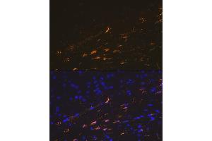 Immunofluorescence analysis of mouse brain cells using GFAP Rabbit pAb (ABIN3020750, ABIN3020751, ABIN3020752, ABIN1512943 and ABIN6213705) at dilution of 1:100 (40x lens). (GFAP anticorps  (C-Term))
