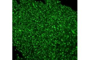 IF analysis of PTBP1 using anti-PTBP1 antibody (ABIN7599450). (PTBP1 anticorps  (AA 1-504))