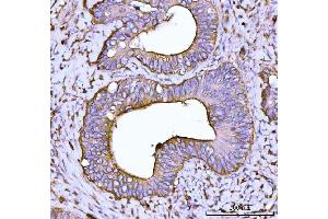 IHC analysis of Alpha Actinin 4 using anti-Alpha Actinin 4 antibody (ABIN4886421). (alpha Actinin 4 anticorps  (AA 561-661))