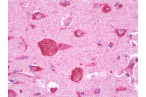 anti-AIMP1 / EMAP II (C-Term) antibody