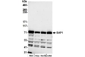 Western Blotting (WB) image for anti-BRCA1 Associated Protein-1 (Ubiquitin Carboxy-terminal Hydrolase) (BAP1) (AA 679-729) antibody (ABIN7454810)