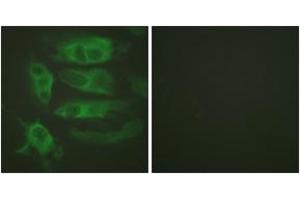 Immunofluorescence analysis of HeLa cells, using Adrenergic Receptor beta2 (Ab-346) Antibody. (beta 2 Adrenergic Receptor anticorps  (AA 321-370))