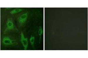 Immunofluorescence analysis of HeLa cells, using Aquaporin 2 (Ab-256) Antibody. (AQP2 anticorps  (AA 222-271))