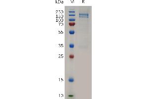 Human R Protein, hFc Tag on SDS-PAGE under reducing condition.