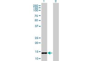 Western Blot analysis of CCNB3 expression in transfected 293T cell line by CCNB3 MaxPab polyclonal antibody. (Cyclin B3 anticorps  (AA 1-111))