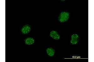Immunofluorescence of purified MaxPab antibody to ELAC1 on HeLa cell. (ELAC1 anticorps  (AA 1-363))