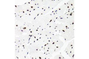 Immunohistochemistry of paraffin-embedded rat heart using H2AFX antibody at dilution of 1:100 (x40 lens). (H2AFX anticorps)