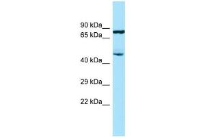 WB Suggested Anti-SMAP2 Antibody Titration: 1. (SMAP2 anticorps  (C-Term))