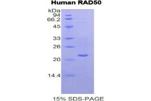 SDS-PAGE analysis of Human RAD50 Protein. (RAD50 Protéine)