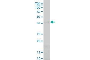 PSMC6 monoclonal antibody (M02), clone 2C4 Western Blot analysis of PSMC6 expression in Hela S3 NE .