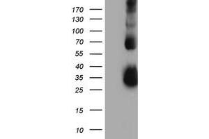 Western Blotting (WB) image for anti-Metalloproteinase Inhibitor 2 (TIMP2) antibody (ABIN1501396) (TIMP2 anticorps)