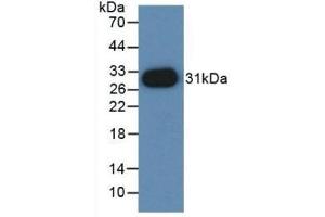 Detection of Recombinant PVRL2, Mouse using Polyclonal Antibody to Nectin 2 (NECTIN2) (PVRL2 anticorps  (AA 83-291))