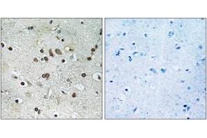 Immunohistochemistry analysis of paraffin-embedded human brain tissue, using BTF3L4 Antibody. (BTF3L4 anticorps  (AA 94-143))