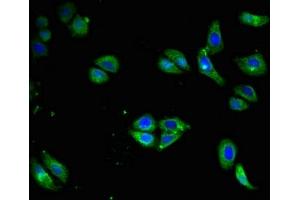 Immunofluorescent analysis of HepG2 cells using ABIN7145141 at dilution of 1:100 and Alexa Fluor 488-congugated AffiniPure Goat Anti-Rabbit IgG(H+L)