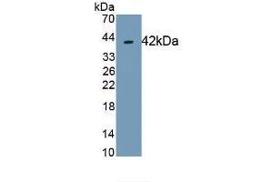 Detection of Recombinant TSPAN30, Human using Monoclonal Antibody to Tetraspanin 30Cluster of Differentiation 63 (CD63)