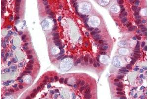 Anti-TMPRSS4 antibody  ABIN1049419 IHC staining of human small intestine.