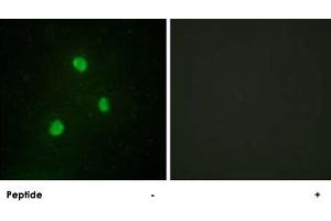 Immunofluorescence analysis of A-549 cells, using TBX1 polyclonal antibody . (T-Box 1 anticorps  (C-Term))