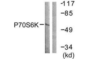 Western blot analysis of extracts from Jurkat cells, using p70 S6 Kinase (Ab-229) Antibody.