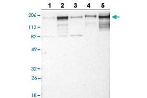 Western blot analysis of Lane 1: RT-4 cell line, Lane 2: U-251MG sp cell line, Lane 3: A-431 cell line, Lane 4: human liver tissue, and Lane 5: human tonsil tissue with LAMC1 polyclonal antibody . (Laminin gamma 1 anticorps  (AA 1442-1552))