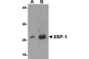 Western Blotting (WB) image for anti-X-Box Binding Protein 1 (XBP1) (AA 2-160) antibody (ABIN492538) (XBP1 anticorps  (AA 2-160))
