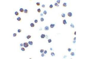 Immunohistochemistry (IHC) image for anti-BCL2-Antagonist/killer 1 (BAK1) (N-Term) antibody (ABIN2477580) (BAK1 anticorps  (N-Term))