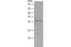 Western Blotting (WB) image for phosphoglycerate Mutase 2 (Muscle) (PGAM2) (AA 1-253) protein (His tag) (ABIN7124422)