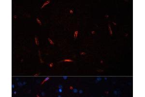 Immunofluorescence analysis of Rat brain using HCRTR1 Polyclonal Antibody at dilution of 1:100. (HCRTR1 anticorps)