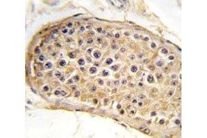 IHC analysis of FFPE human testis tissue stained with RICTOR antibody (RICTOR anticorps  (AA 236-267))